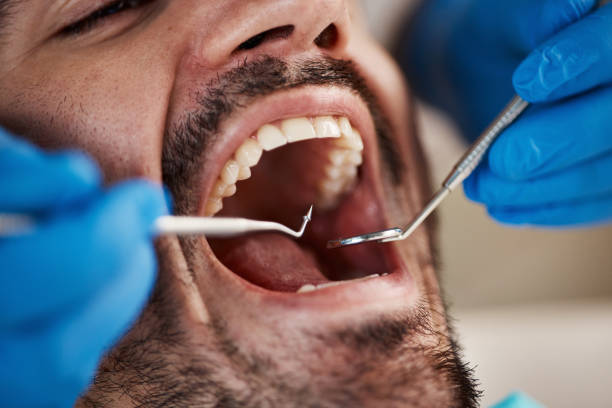 Best Emergency Dentist for Knocked-Out Tooth in William Paterson University Of New Jersey, NJ