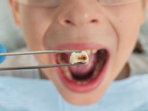 Best Emergency Dentist for Knocked-Out Tooth in William Paterson University Of New Jersey, NJ